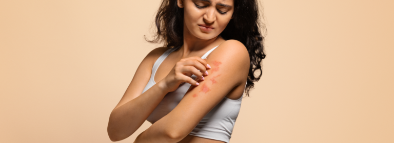 8 Home remedies for itchy skin – Doctor picked 