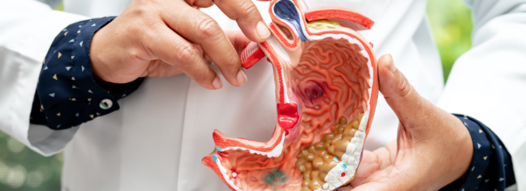 What foods neutralise stomach acid? Doctor-approved tips