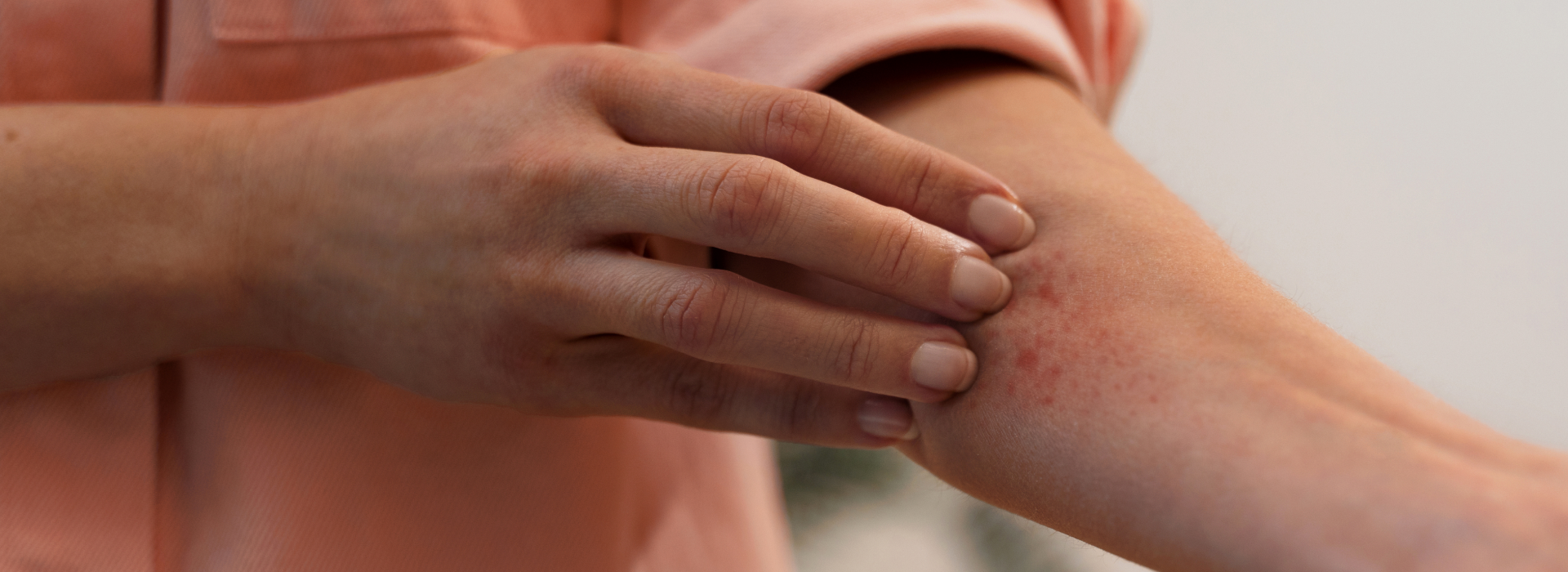 Fungal skin infection: Types and home remedies