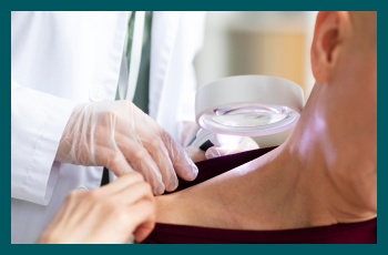 Regular skin checks for Aussies: A lifesaving habit
