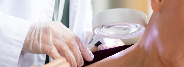 Regular skin checks for Aussies: A lifesaving habit 
