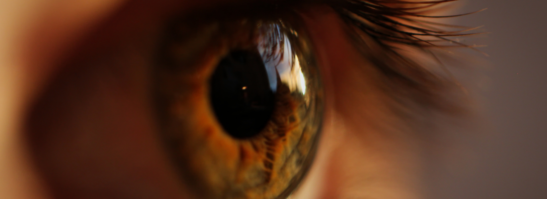 Stye self-care: Home remedies & treatment 