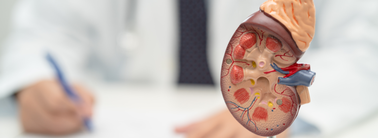Kidney infections: symptoms, causes, and treatment