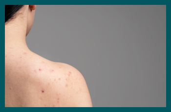 Red spots on skin: causes & when to worry?