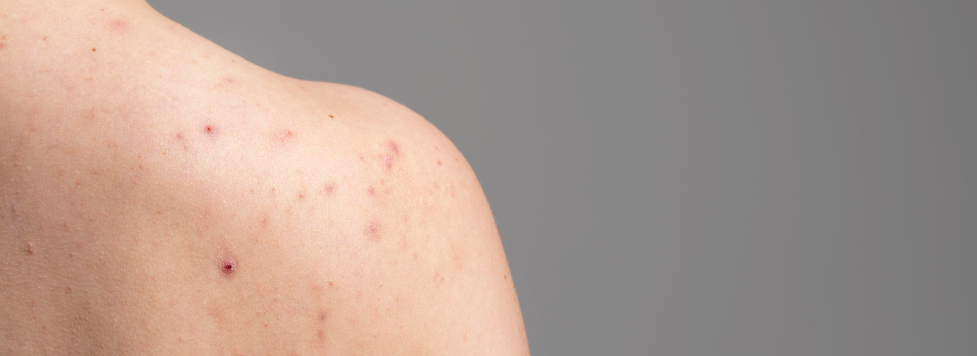 Red spots on skin: causes & when to worry? 