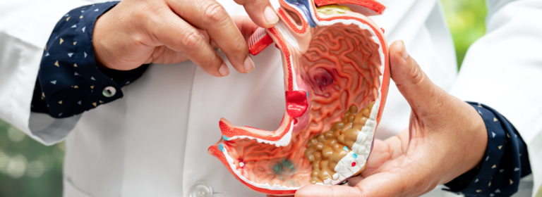 Understanding gastro-oesophageal reflux disease (GORD) in adults