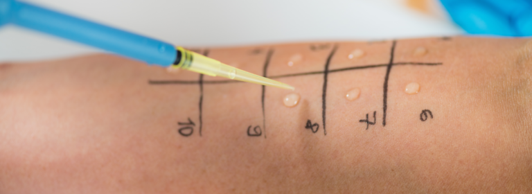 Skin checks in Australia – why it should be a priority? 