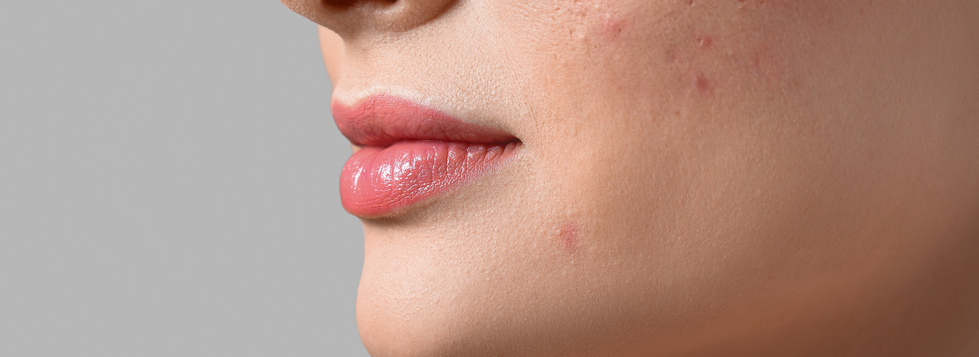 White spots on skin: Possible causes and next steps 