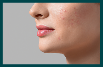 White spots on skin: Possible causes and next steps